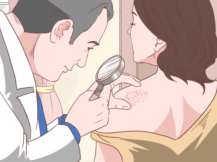 5 Manières De Se Débarrasser De Démangeaisons Avec Des pour Demangeaison Apres La Douche