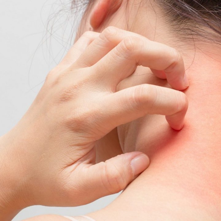 Comment Apaiser Les Démangeaisons ? – Pharmashopi – Santé tout Demangeaison Apres La Douche