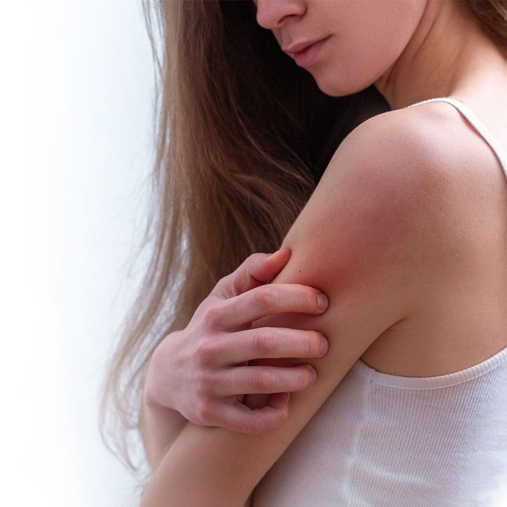 La Démangeaison De La Peau : Un Symptôme Aux Multiples dedans Demangeaison Apres La Douche