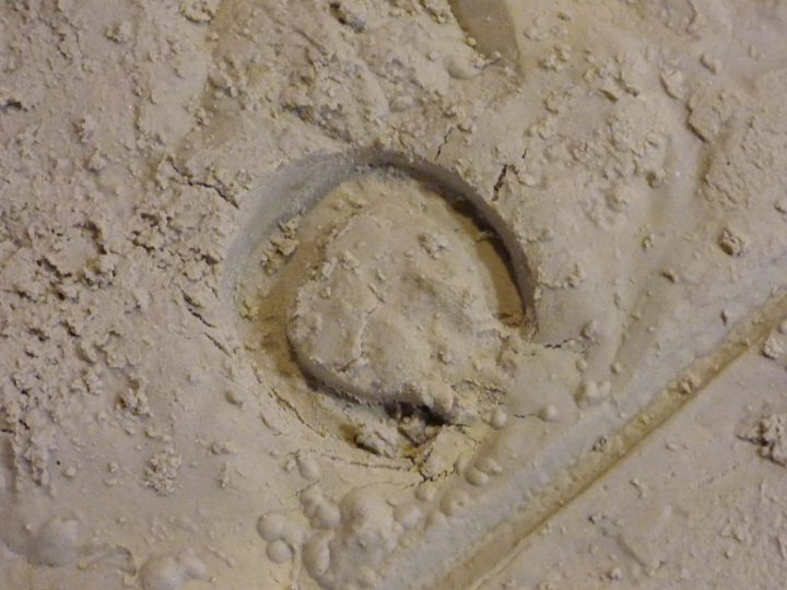 Les Jours Passent… | Montagnes D'Espoir, Le Blog D'Emilie tout Chambre Implantable Cip