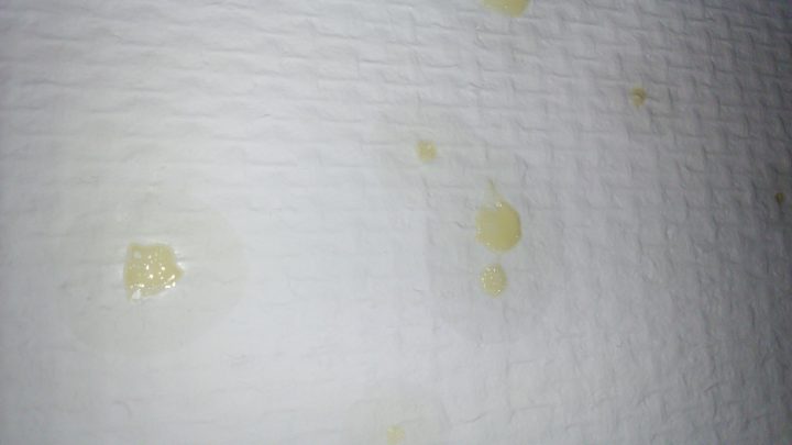 Tâches Jaunes Sur Le Mur De La Chambre – Linternaute encequiconcerne Moisissure Plafond Salle De Bain