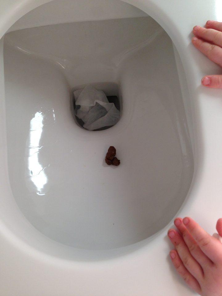 Caca Boudin | Peace And Morve destiné Toilettes Bouchées Que Faire