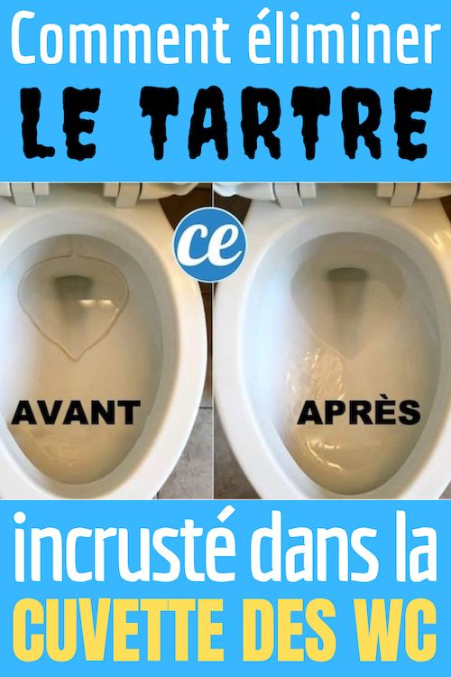 L'Astuce Simple Et Rapide Pour Blanchir Le Fond De La à Comment Nettoyer Le Fond Des Toilettes