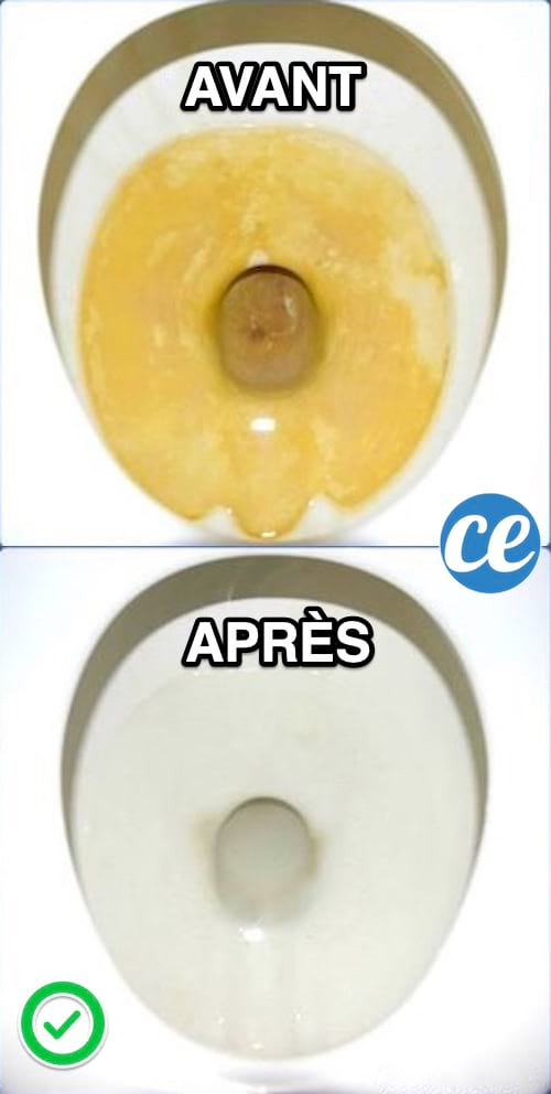 Le Truc Efficace Pour Nettoyer Le Fond De La Cuvette avec Comment Nettoyer Le Fond Des Toilettes