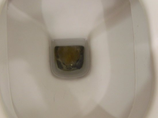 Montage – Bild Från Sherwood Greenwood Resort, Goynuk pour Enlever Tartre Toilette Montage – Bild Från Sherwood Greenwood Resort, Goynuk pour Enlever Tartre Toilette