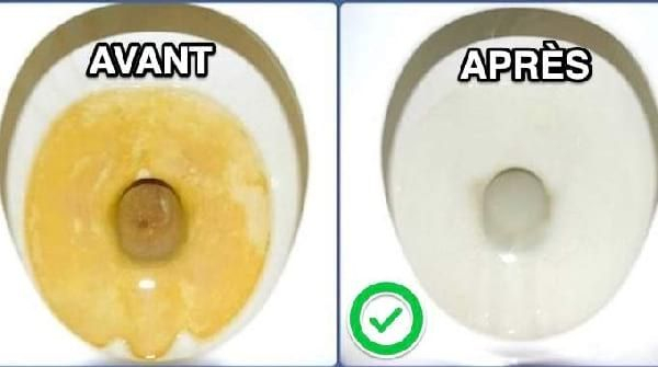 Top 10 Des Astuces De La Semaine : Nettoyer Le Fond Des Wc concernant Nettoyer Le Fond Des Toilettes Top 10 Des Astuces De La Semaine : Nettoyer Le Fond Des Wc concernant Nettoyer Le Fond Des Toilettes