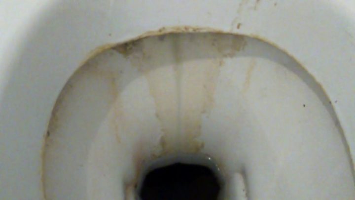 [Tuto] Enlever Une Grosse Plaque De Tartre (Cuvette à Comment Nettoyer Des Toilettes