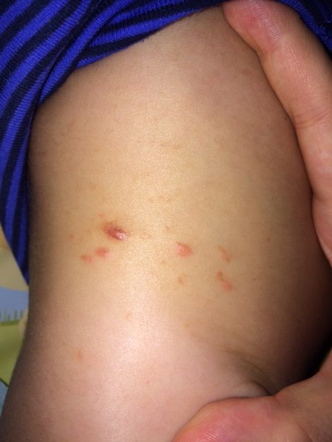 hautkrankheiten bei haustieren hautkrankheiten bei haustieren