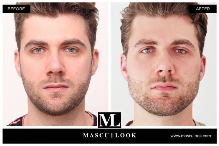 maniküre männer vorher nachher