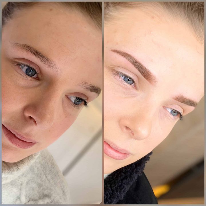 [40+] Tatouage Des Sourcils Pendant La Chimiotherapie tout Microshading Toulouse