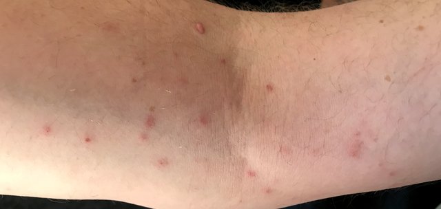 thuja c30 impfung dosierung