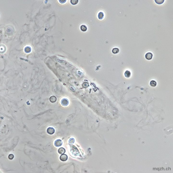 urinsediment mikroskopie urinsediment bilder mit beschreibung