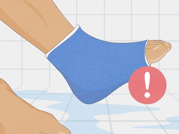 blaue beine nach duschen blaue beine nach duschen