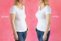breast augmentation with implants