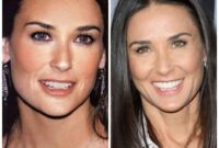 demi moore teeth surgery before and after demi moore teeth surgery before and after