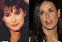 demi moore before and after plastic surgery demi moore before and after plastic surgery