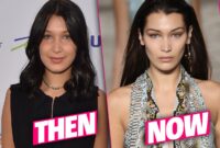 bella hadid before and after