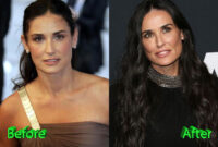 demi moore bad surgery demi moore bad surgery