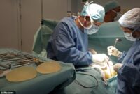 breast implant surgeons in essex