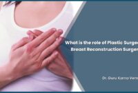 breast implants reconstruction breast implants reconstruction