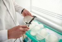 breast implant removal after 10 years breast implant removal after 10 years