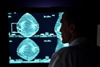 breast cancer icd 10 lookup