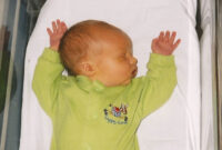 breastfeeding jaundice baby breastfeeding jaundice baby