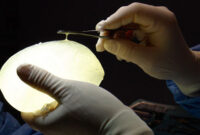 breast implant surgeons in rochester ny breast implant surgeons in rochester ny
