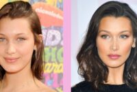 bella hadid before and after plastic surgery bella hadid before and after plastic surgery