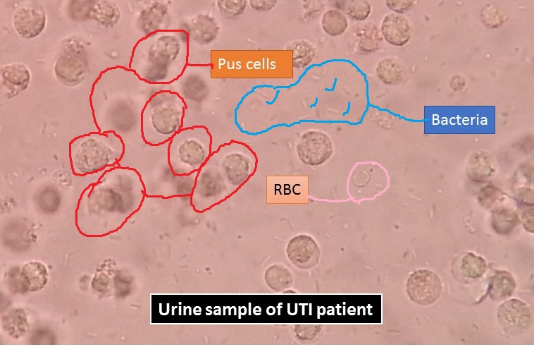 Microbiology Urine Culture